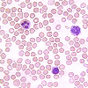 Types Of White Blood Cells And Their Functions