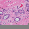 Types Of Cardiac Cells