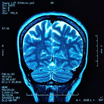 Types Of Brain Tumors