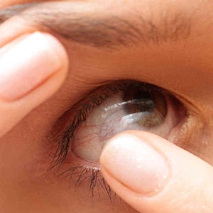 Types Of Contact Lenses