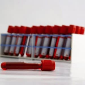 Types Of Blood Lab Tests